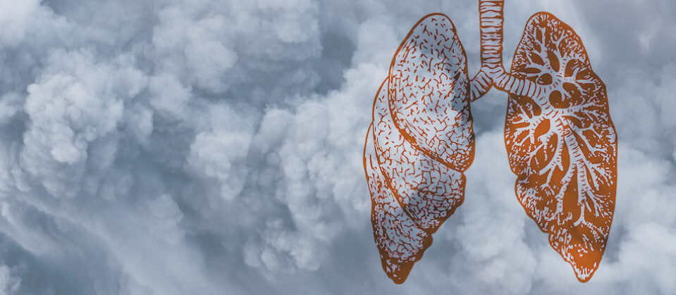 An illustration of lungs overlaid on clouds of smog