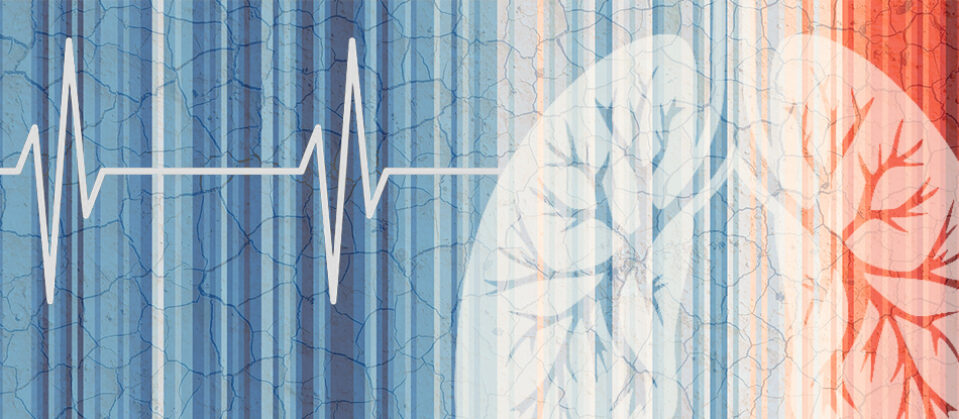 An illustrated depiction of lungs and a heart monitor line in front of the iconic climate stripes.