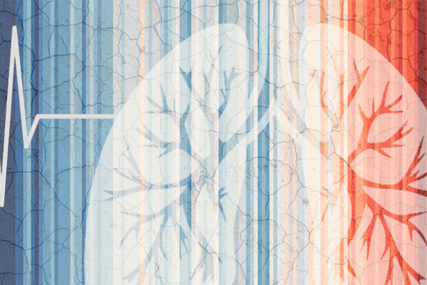 An illustrated depiction of lungs and a heart monitor line in front of the iconic climate stripes.